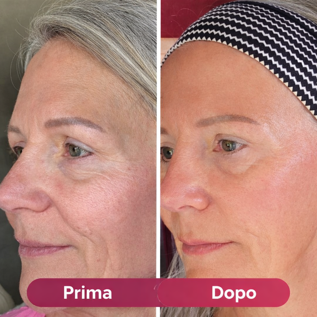 GlowBella™ Maschera Collagen Lifting